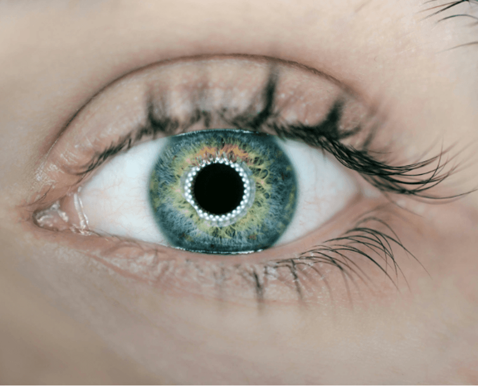 Research Calls for Joint Effort in Uveitis and Autoimmune Disease Mangement