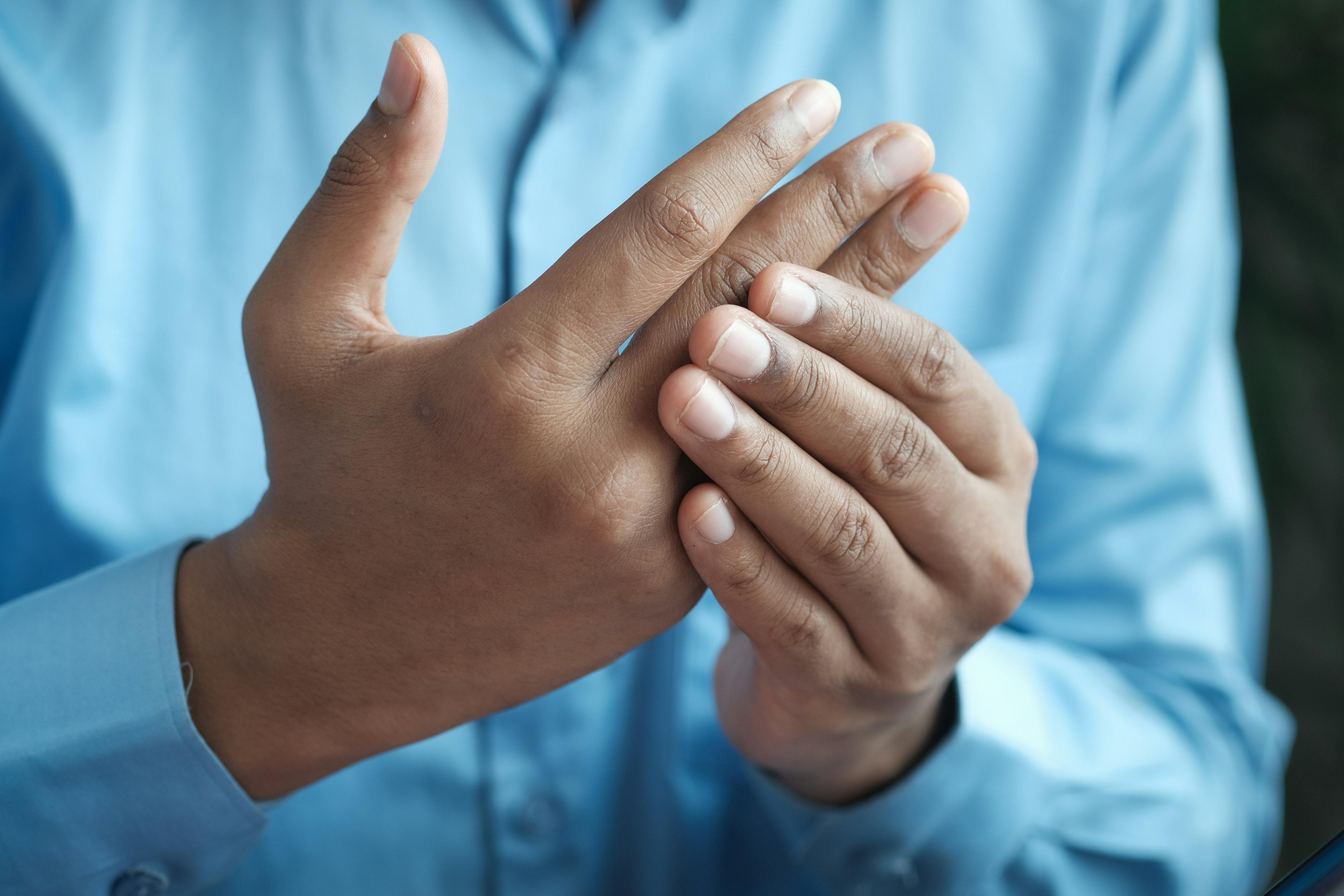 High Triglyceride Glycemic Levels Linked to Gout Risk